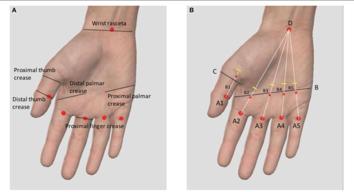 Cpt code for a1 pulley release