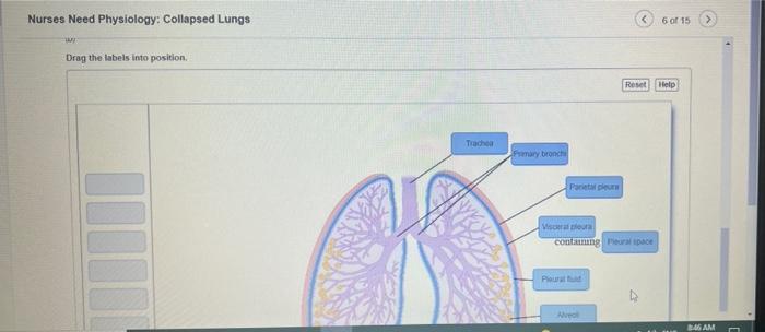 Nurses need physiology collapsed lungs