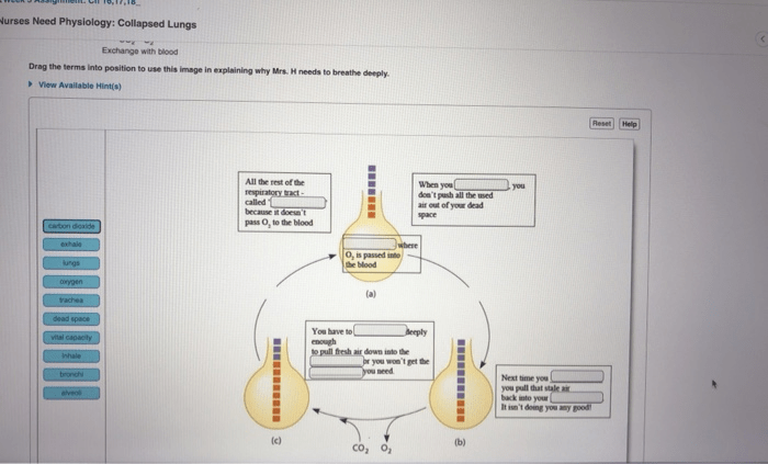 Nurses need physiology collapsed lungs